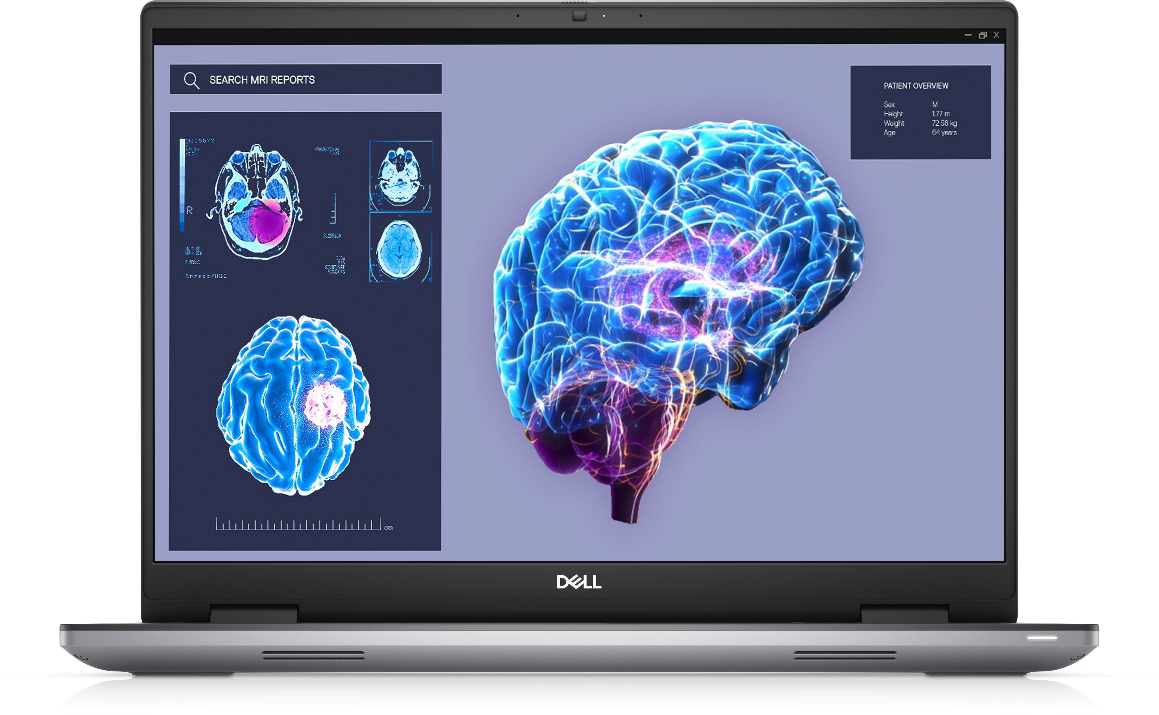DELL Precision 7680 Intel® Core™ i9 i9-13950HX Mobile workstation 40.6 cm (16") Full HD+ 64 GB DDR5-SDRAM 1 TB SSD NVIDIA RTX 3500 Ada Wi-Fi 6E (802.11ax) Windows 11 Pro Grey